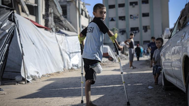 EuroMed: Gazze'de 3 yıllık soykırımda 10 binden fazla çocuk uzuv kaybı yaşadı